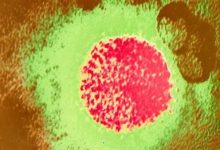 حقائق ومعلومات عن حمى لاسا